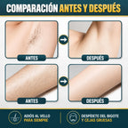Crema Depilatoria para Hombre - Piel suave y sin vellos en minutos - Almega Colombia - vista 4