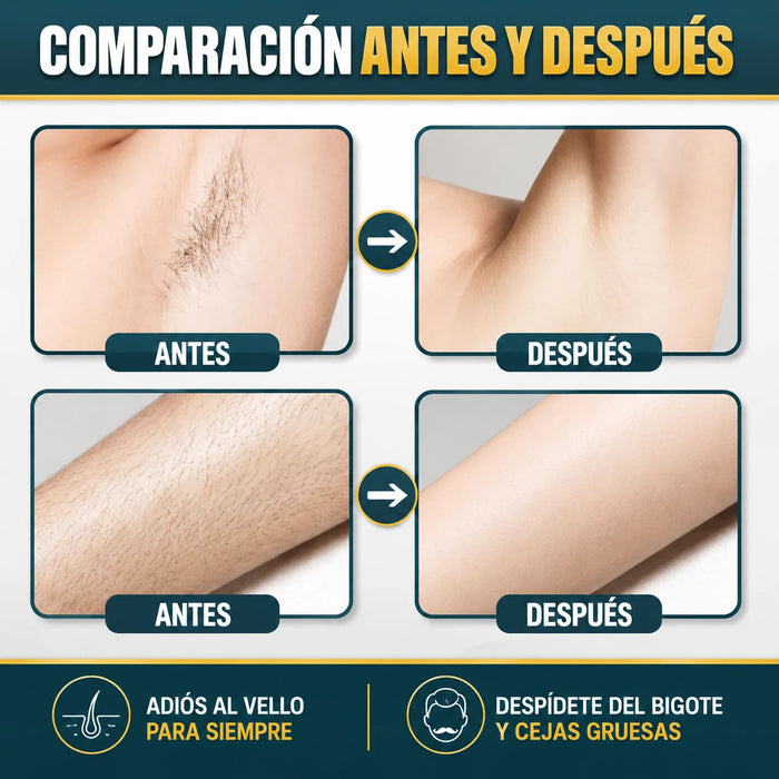 Crema Depilatoria para Hombre - Piel suave y sin vellos en minutos - Almega Colombia - vista 4